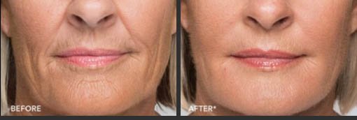 Before and After Photo