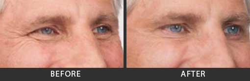 Before and After Photo