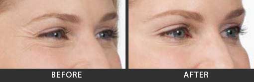 Before and After Photo