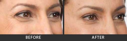 Before and After Photo