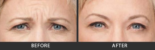 Before and After Photo