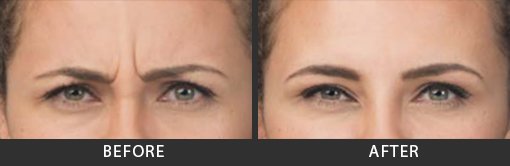 Before and After Photo