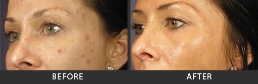 Before and After Photo