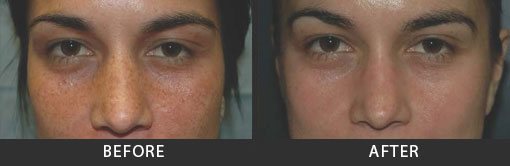 Before and After Photo