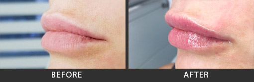 Before and After Photo