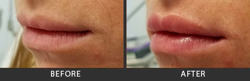 Before and After Photo