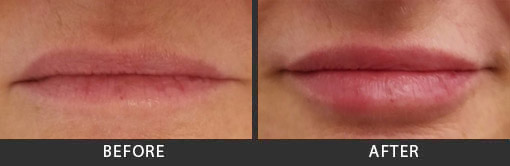 Before and After Photo