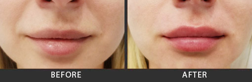 Before and After Photo