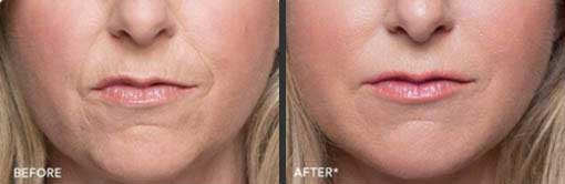 Before and After Photo