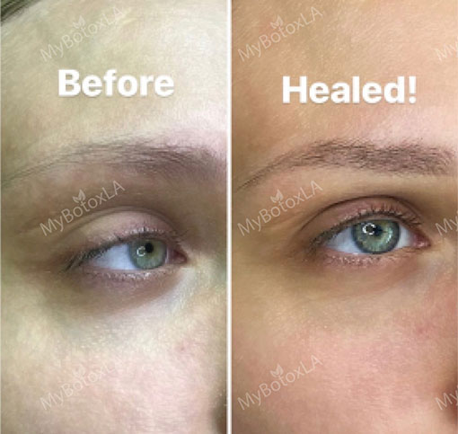 Before and After Photo