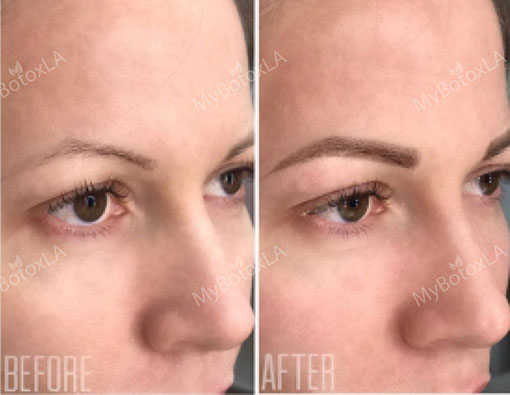 Before and After Photo