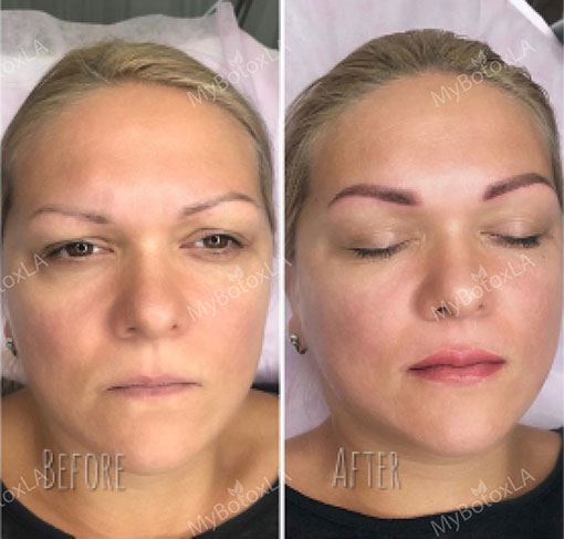 Before and After Photo