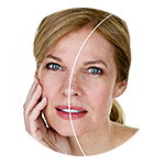 Vampire Facial Los Angeles