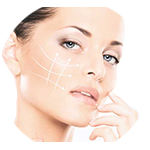 Cheekbone Enhancement