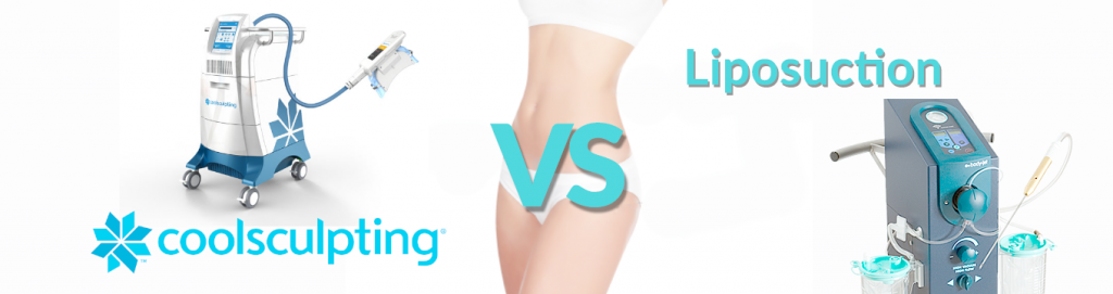 CoolSculpting vs Liposuction